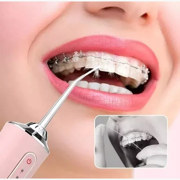 Limpiador Bucal Irrigador Dental Oral Limpiador De Dientes